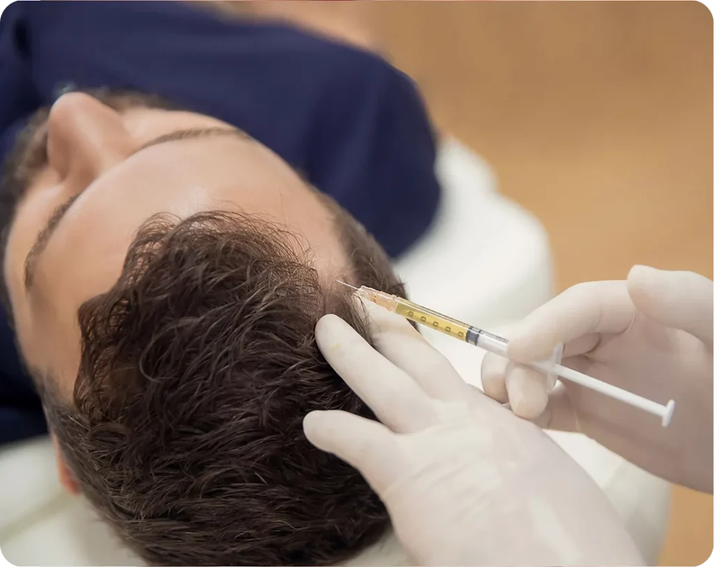 Es Adecuada La Mesoterapia Capilar
